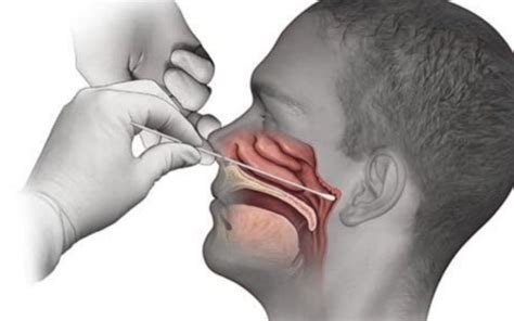 pcr-swab.jpg